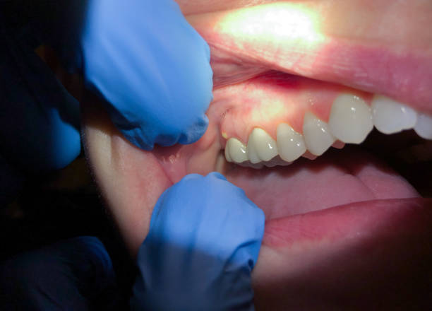 Best Pediatric Emergency Dentist in Kettering, OH